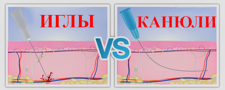 Важное различие между Канюлей и иглой